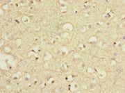 Immunohistochemistry of paraffin-embedded human brain tissue using CSB-PA618911ESR1HU at dilution of 1:100