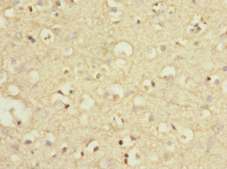 Immunohistochemistry of paraffin-embedded human brain tissue using CSB-PA618911ESR1HU at dilution of 1:100