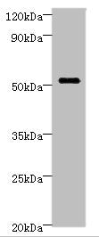 Western blot All lanes: STARD3 Antibody at 6ug/ml + MCF-7 whole cell lysate Secondary Goat polyclonal to rabbit IgG at 1/10000 dilution Predicted band size: 51, 49, 50 kDa Observed band size: 51 kDa