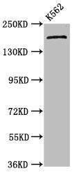 Western Blot Positive WB detected in: K562 whole cell lysate All lanes: PSME4 antibody at 4.5ug/ml Secondary Goat polyclonal to rabbit IgG at 1/50000 dilution Predicted band size: 212, 140, 114, 25 kDa Observed band size: 212 kDa