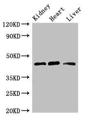 Western Blot Positive WB detected in: Mouse kidney tissue, Rat heart tissue, Rat liver tissue All lanes: WTAP antibody at 3ug/ml Secondary Goat polyclonal to rabbit IgG at 1/50000 dilution Predicted band size: 45, 18 kDa Observed band size: 45 kDa