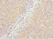 Immunohistochemistry of paraffin-embedded human tonsil tissue using CSB-PA618977DSR2HU at dilution of 1:100