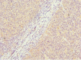 Immunohistochemistry of paraffin-embedded human tonsil tissue using CSB-PA618977DSR2HU at dilution of 1:100