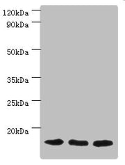 Western blot All lanes: Mitochondrial import receptor subunit TOM20 homolog antibody at 3ug/ml Lane 1: Mouse brain tissue Lane 2: Hela whole cell lysate Lane 3: Mouse liver tissue Secondary Goat polyclonal to rabbit IgG at 1/10000 dilution Predict...