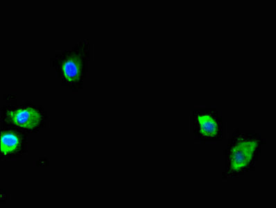 Immunofluorescent analysis of Hela cells using CSB-PA618985LA01HU at dilution of 1:100 and Alexa Fluor 488-congugated AffiniPure Goat Anti-Rabbit IgG(H+L)