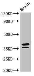 Western Blot Positive WB detected in: Mouse brain tissue All lanes: MAPRE2 antibody at 3ug/ml Secondary Goat polyclonal to rabbit IgG at 1/50000 dilution Predicted band size: 38, 30, 36, 33, 31 kDa Observed band size: 38, 36 kDa