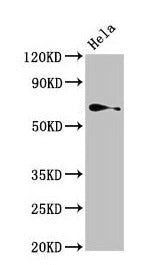 Western Blot Positive WB detected in: Hela whole cell lysate All lanes: TRIP4 antibody at 4µg/ml Secondary Goat polyclonal to rabbit IgG at 1/50000 dilution Predicted band size: 67 kDa Observed band size: 67 kDa