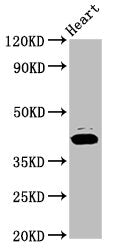 Western Blot Positive WB detected in: Rat heart tissue All lanes: NSDHL antibody at 7.2ug/ml Secondary Goat polyclonal to rabbit IgG at 1/50000 dilution Predicted band size: 42 kDa Observed band size: 42 kDa