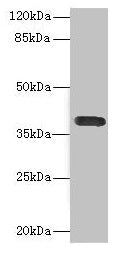 Western blot All lanes: CD226 antibody at 2.61µg/ml + A549 whole cell lysate Secondary Goat polyclonal to rabbit IgG at 1/10000 dilution Predicted band size: 39 kDa Observed band size: 39 kDa