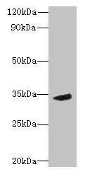 Western blot All lanes: MPPED2 antibody at 6µg/ml + Mouse brain tissue Secondary Goat polyclonal to rabbit IgG at 1/10000 dilution Predicted band size: 34, 32 kDa Observed band size: 34 kDa