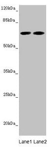 Western blot All lanes: STXBP2 antibody at 5.88µg/ml Lane 1: Mouse brain tissue Lane 2: A549 whole cell lysate Secondary Goat polyclonal to rabbit IgG at 1/10000 dilution Predicted band size: 67, 68 kDa Observed band size: 67 kDa