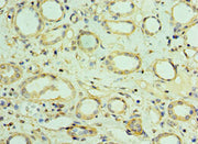 Immunohistochemistry of paraffin-embedded human kidney tissue using CSB-PA619000ESR1HU at dilution of 1:100