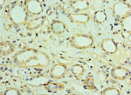 Immunohistochemistry of paraffin-embedded human kidney tissue using CSB-PA619000ESR1HU at dilution of 1:100
