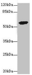 Western blot All lanes: ETFDH antibody at 3.56µg/ml + 293T whole cell lysate Secondary Goat polyclonal to rabbit IgG at 1/10000 dilution Predicted band size: 69, 63 kDa Observed band size: 63 kDa
