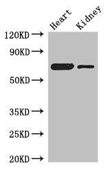 Western Blot Positive WB detected in: Mouse heart tissue, Mouse kidney tissue All lanes: ETFDH antibody at 3µg/ml Secondary Goat polyclonal to rabbit IgG at 1/50000 dilution Predicted band size: 69, 63 kDa Observed band size: 69 kDa