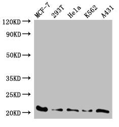 Western Blot Positive WB detected in: MCF-7 whole cell lysate, 293T whole cell lysate, Hela whole cell lysate, K562 whole cell lysate, A431 whole cell lysate All lanes: AK6 antibody at 0.59ug/ml Secondary Goat polyclonal to rabbit IgG at 1/50000 d...