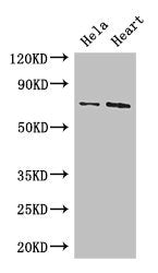 Western Blot Positive WB detected in: Hela whole cell lysate, Mouse heart tissue All lanes: PCK2 antibody at 3.4µg/ml Secondary Goat polyclonal to rabbit IgG at 1/50000 dilution Predicted band size: 71, 48, 56 kDa Observed band size: 71 kDa