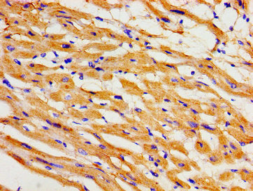 Immunohistochemistry of paraffin-embedded human heart tissue using CSB-PA619634LA01HU at dilution of 1:100