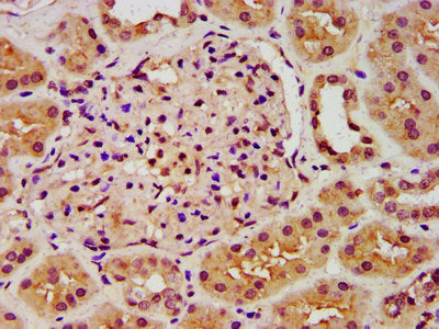 IHC image of CSB-PA619642LA01HU diluted at 1:300 and staining in paraffin-embedded human kidney tissue performed on a Leica BondTM system. After dewaxing and hydration, antigen retrieval was mediated by high pressure in a citrate buffer (pH 6.0)....