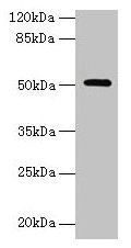 Western blot All lanes: NR1H3 antibody at 6µg/ml + Mouse liver tissue Secondary Goat polyclonal to rabbit IgG at 1/10000 dilution Predicted band size: 51, 44, 46 kDa Observed band size: 51 kDa