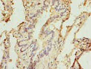 Immunohistochemistry of paraffin-embedded human lung tissue using CSB-PA619754ESR1HU at dilution of 1:100