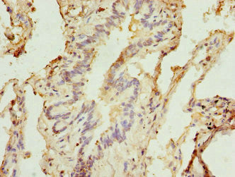 Immunohistochemistry of paraffin-embedded human lung tissue using CSB-PA619754ESR1HU at dilution of 1:100