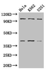 Western Blot Positive WB detected in: Hela whole cell lysate, K562 whole cell lysate, U251 whole cell lysate All lanes: PSMD2 antibody at 3µg/ml Secondary Goat polyclonal to rabbit IgG at 1/50000 dilution Predicted band size: 101, 83, 86 kDa Obser...