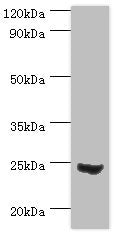 Western blot All lanes: Mitotic spindle assembly checkpoint protein MAD2A antibody at 3ug/ml + 293T whole cell lysate Secondary Goat polyclonal to rabbit IgG at 1/10000 dilution Predicted band size: 24, 11 kDa Observed band size: 24 kDa