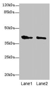 Western blot All lanes: GPR17 antibody at 10µg/ml Lane 1: Mouse brain tissue Lane 2: Human high value serum Secondary Goat polyclonal to rabbit IgG at 1/10000 dilution Predicted band size: 41, 38 kDa Observed band size: 41 kDa