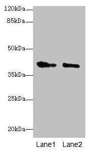 Western blot All lanes: GPR17 antibody at 10µg/ml Lane 1: Mouse brain tissue Lane 2: Human high value serum Secondary Goat polyclonal to rabbit IgG at 1/10000 dilution Predicted band size: 41, 38 kDa Observed band size: 41 kDa