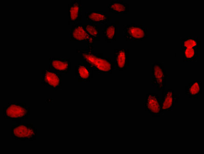 Immunofluorescent analysis of Hela cells using CSB-PA619760LA01HU at dilution of 1:100 and Cy3-congugated Goat Anti-Rabbit IgG