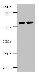 Western blot All lanes: PPP2R5C antibody at 1.31ug/ml Lane 1: MM231 whole cell lysate Lane 2: K562 whole cell lysate Secondary Goat polyclonal to rabbit IgG at 1/10000 dilution Predicted band size: 62, 53, 57, 63, 65 kDa Observed band size: 62 kDa