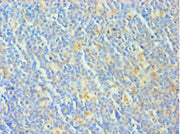 Immunohistochemistry of paraffin-embedded human tonsil tissue using CSB-PA619765DSR2HU at dilution of 1:100