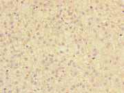 Immunohistochemistry of paraffin-embedded human adrenal gland tissue using CSB-PA619766ESR2HU at dilution of 1:100