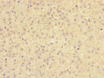 Immunohistochemistry of paraffin-embedded human adrenal gland tissue using CSB-PA619766ESR2HU at dilution of 1:100