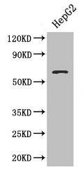 Western blot All lanes: SMAD4 antibody at 3µg/ml + HepG2 whole cell lysate Secondary Goat polyclonal to rabbit IgG at 1/10000 dilution Predicted band size: 61 kDa Observed band size: 61 kDa