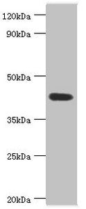 Western blot All lanes: Acid ceramidase antibody at 6ug/ml + Mouse heart tissue Secondary Goat polyclonal to rabbit IgG at 1/10000 dilution Predicted band size: 45, 47 kDa Observed band size: 45 kDa