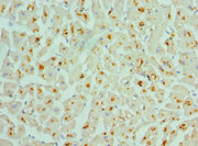 Immunohistochemistry of paraffin-embedded human heart tissue using CSB-PA619774ESR2HU at dilution of 1:100