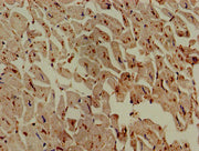 Immunohistochemistry of paraffin-embedded human heart tissue using CSB-PA619774LA01HU at dilution of 1:100