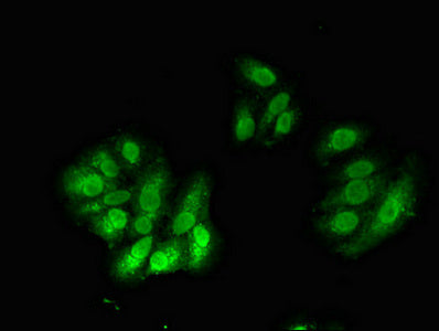 Immunofluorescent analysis of HepG2 cells using CSB-PA619782LA01HU at dilution of 1:100 and Alexa Fluor 488-congugated AffiniPure Goat Anti-Rabbit IgG(H+L)