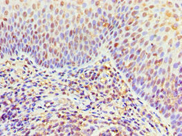 Immunohistochemistry of paraffin-embedded human tonsil tissue using CSB-PA619792ESR2HU at dilution of 1:100