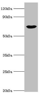 Western blot All lanes: cGMP-dependent protein kinase 1 antibody at 3ug/ml + Mouse lung tissue Secondary Goat polyclonal to rabbit IgG at 1/10000 dilution Predicted band size: 77, 78, 45 kDa Observed band size: 77 kDa