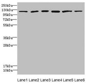 Western blot All lanes: UBE4A antibody at 2.24µg/ml Lane 1: K562 whole cell lysate Lane 2: MCF-7 whole cell lysate Lane 3: Jurkat whole cell lysate Lane 4: Caco-2 whole cell lysate Lane 5: HepG2 whole cell lysate Lane 6: 293T whole cell lysate Sec...