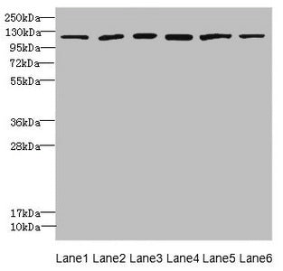 Western blot All lanes: UBE4A antibody at 2.24µg/ml Lane 1: K562 whole cell lysate Lane 2: MCF-7 whole cell lysate Lane 3: Jurkat whole cell lysate Lane 4: Caco-2 whole cell lysate Lane 5: HepG2 whole cell lysate Lane 6: 293T whole cell lysate Sec...