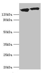 Western blot All lanes: DCTN1 antibody at 20µg/ml Lane 1: Mouse brain tissue Lane 2: Jurkat whole cell lysate Secondary Goat polyclonal to rabbit IgG at 1/10000 dilution Predicted band size: 142, 128, 137, 139, 127, 141 kDa Observed band size: 142...
