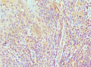Immunohistochemistry of paraffin-embedded human tonsil tissue using CSB-PA619867ESR2HU at dilution of 1:100
