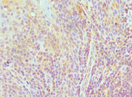 Immunohistochemistry of paraffin-embedded human tonsil tissue using CSB-PA619867ESR2HU at dilution of 1:100