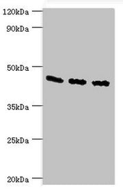 Western blot All lanes: Flotillin-2 antibody at 4ug/ml Lane 1: A549 whole cell lysate Lane 2: Hela whole cell lysate Lane 3: Rat brain tissue Secondary Goat polyclonal to rabbit IgG at 1/10000 dilution Predicted band size: 47 kDa Observed band siz...