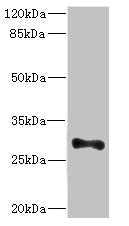Western blot All lanes: ICAM4 antibody at 4.98ug/ml + Mouse brain tissue Secondary Goat polyclonal to rabbit IgG at 1/10000 dilution Predicted band size: 30, 26 kDa Observed band size: 30 kDa