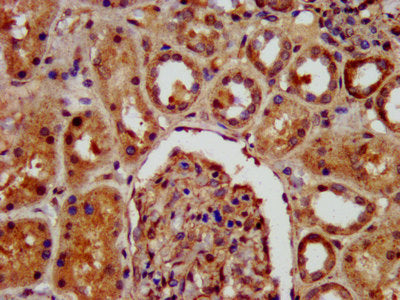 IHC image of CSB-PA619894LA01HU diluted at 1:400 and staining in paraffin-embedded human kidney tissue performed on a Leica BondTM system. After dewaxing and hydration, antigen retrieval was mediated by high pressure in a citrate buffer (pH 6.0)....